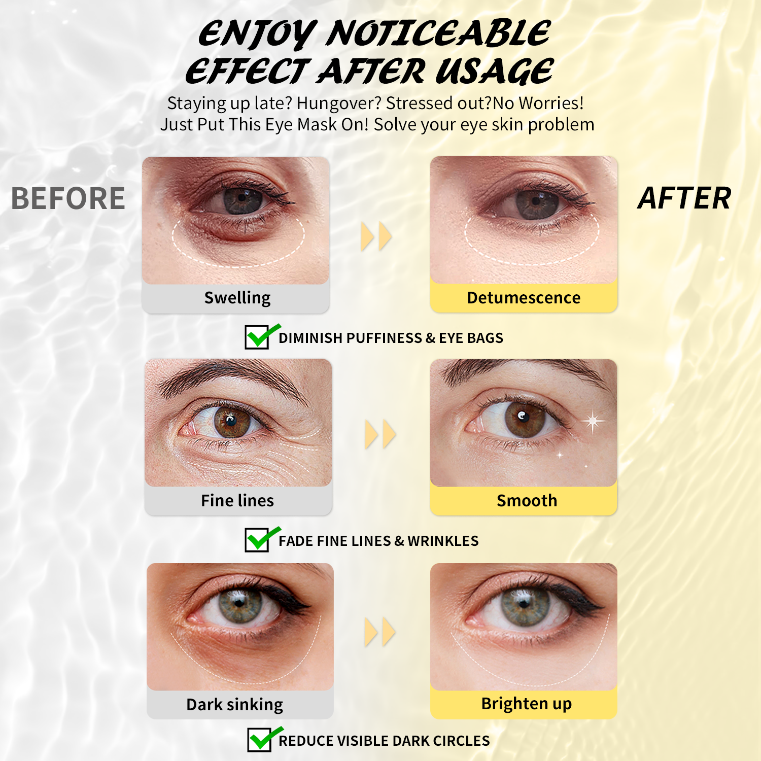 Maskiss Under Eye Patches (30 Pairs), Hyaluronic Acid Eye Masks for Dark Circles Puffy Eyes Undereye Bags, Collagen Eye Patches for Wrinkles and Hydrate, Skin Care Gift for Her